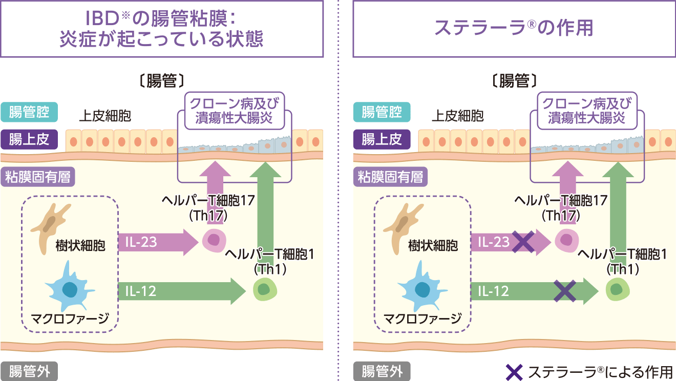 ステラーラ®はIL-12とIL-23を抑えます