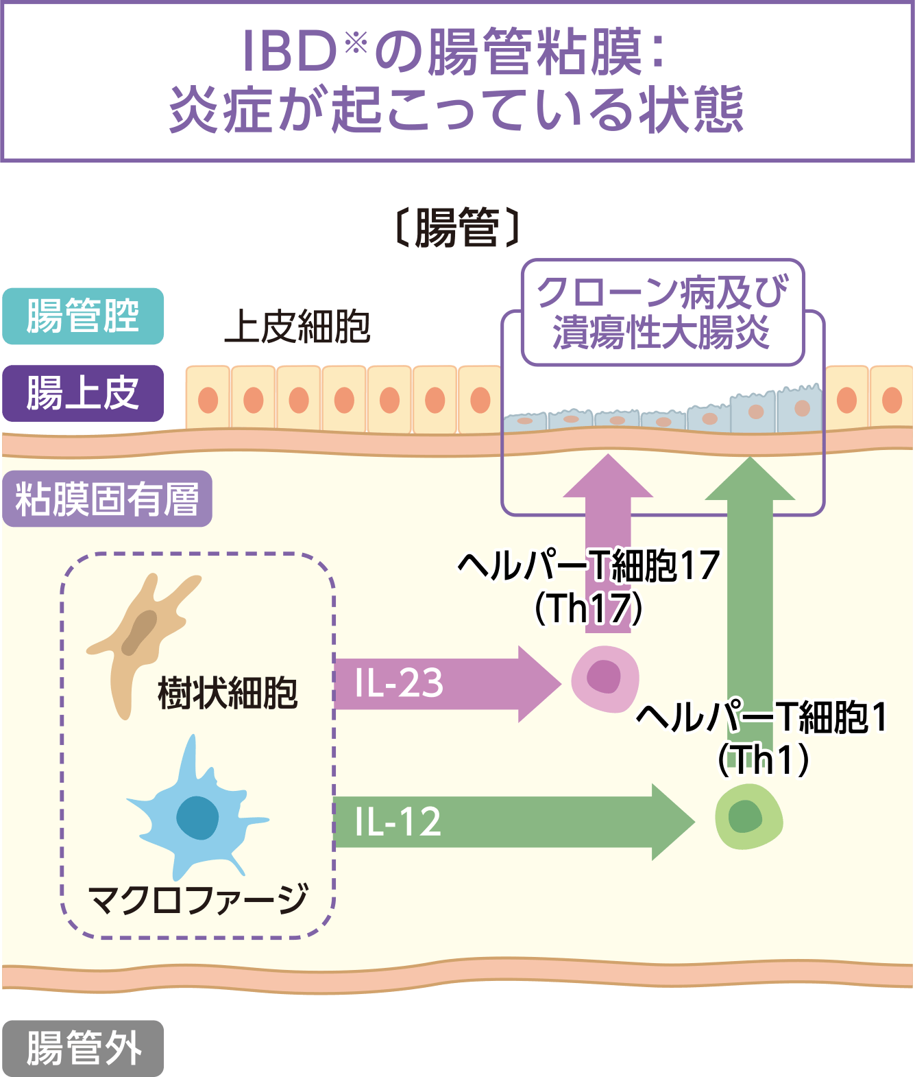 ステラーラ®はIL-12とIL-23を抑えます