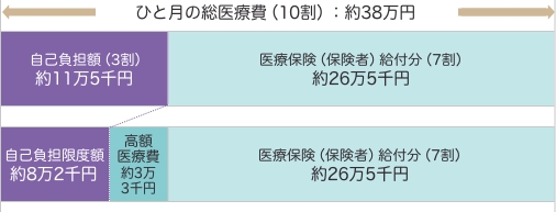 自己負担模式図