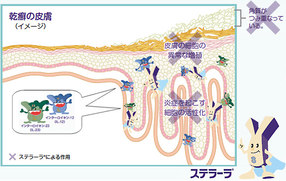乾癬に対するステラーラの作用イメージ
